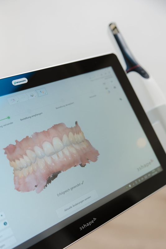 3Shape TRIOS Intraoralscanner